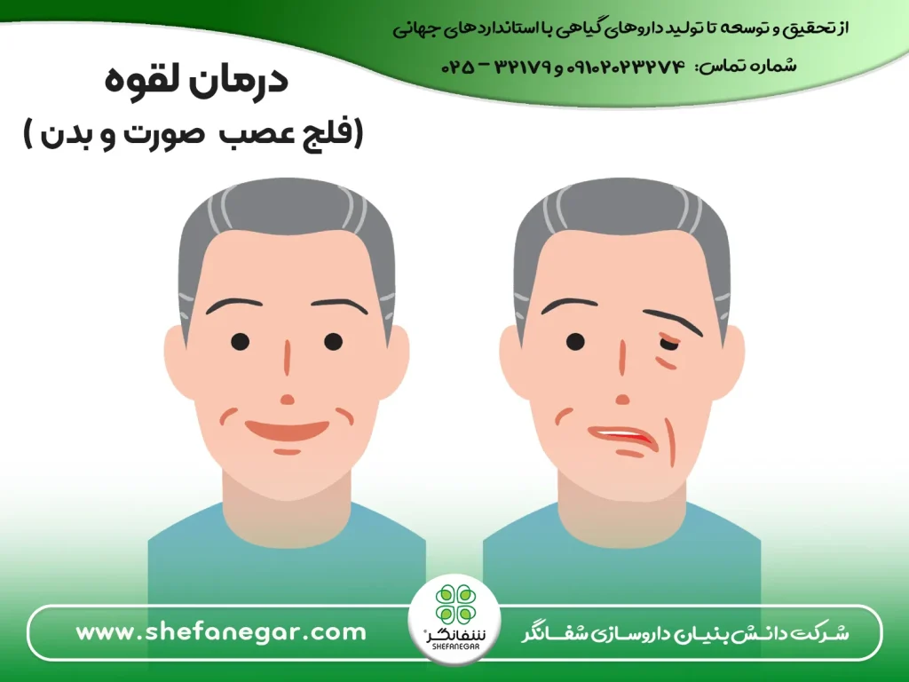 درمان-لقوه-فلج-عصب-صورت-و-بدن-با-قرص-ایارج-فیقرا