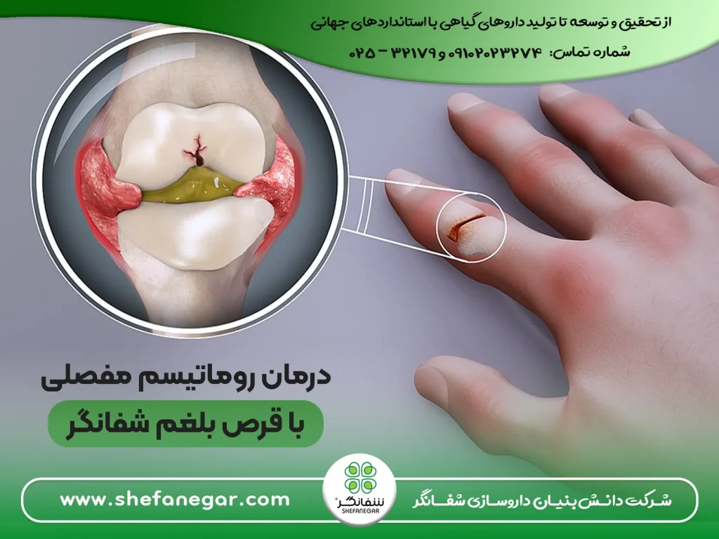 درمان_-روماتیسم-مفصلی-و-درد-مفاصل-با-داروهای-گیاهی-قرص-بلغم-(-دواء-البلغم)-شفانگر