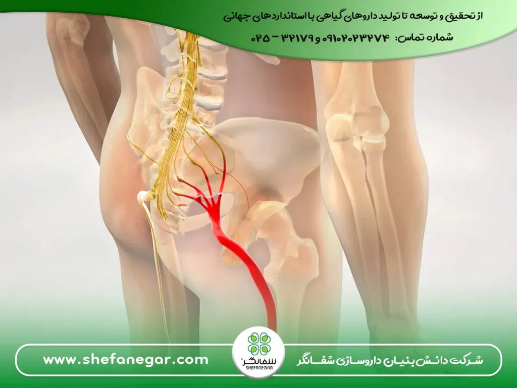 برای-درد-سیاتیک-چی-بخوریم؟ کپسول گیاهی سورنجان شفانگر