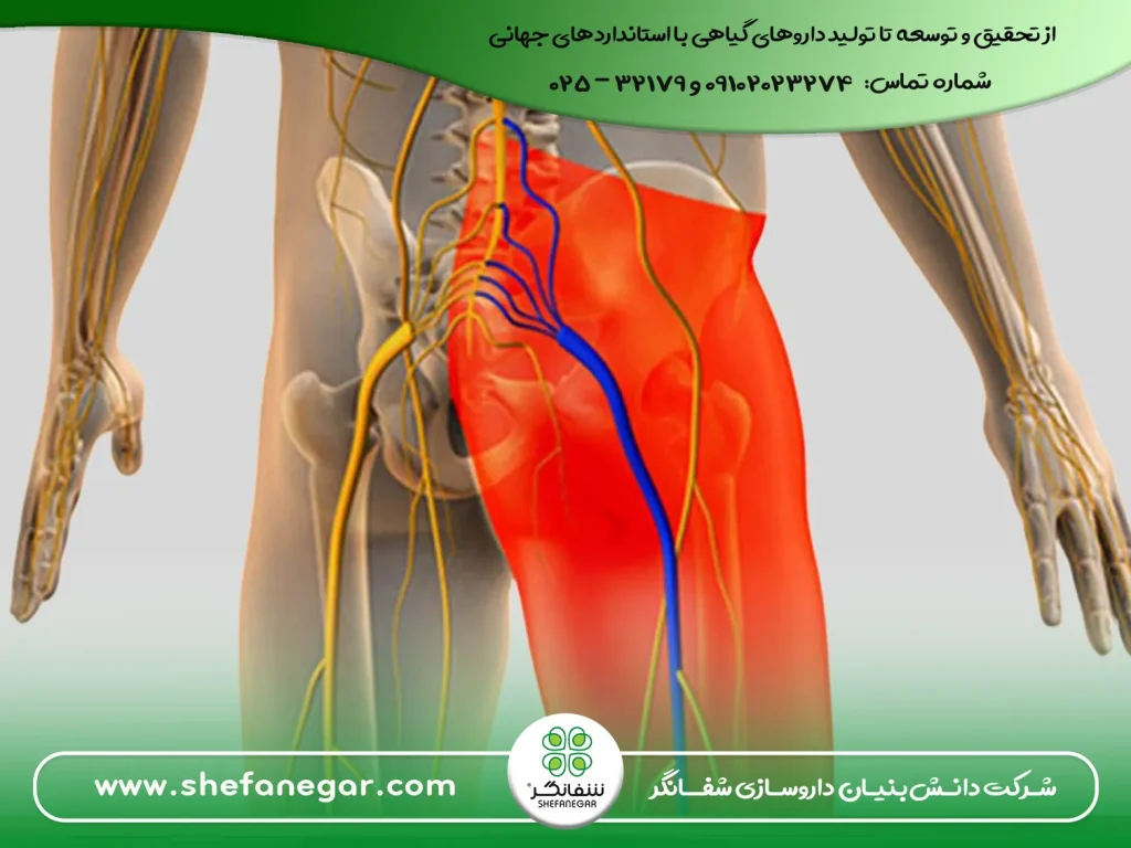 درمان-درد-سیاتیک-با-کپسول-سورنجان-شفانگر