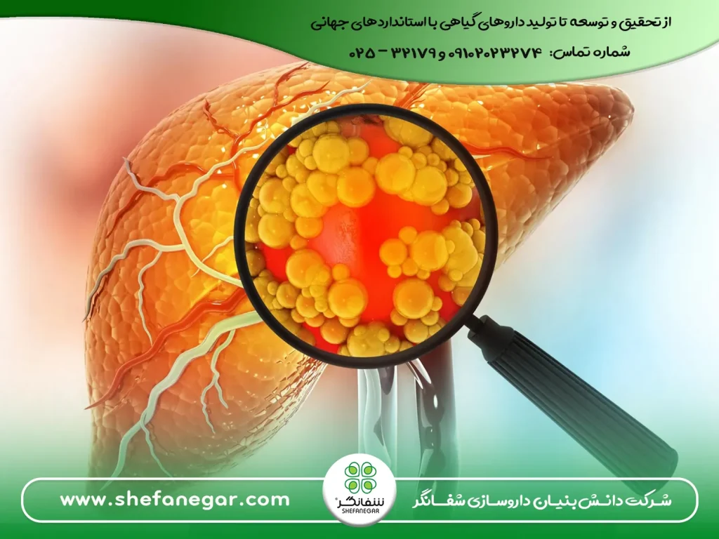 راهنمای-جامع-و-کامل-درمان-طبیعی-کبد-چرب-قرص-بلغم(دواء-البلغم)-شفانگر