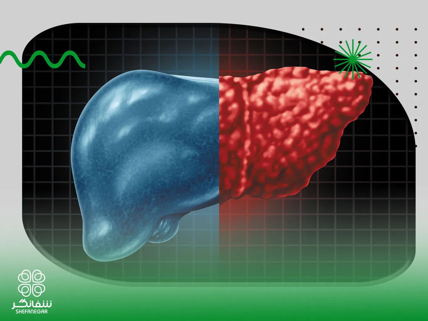 درمان-همیشگی-کبد-چرب-با-گیاهان-دارویی--راهکار-طبیعی-پاکسازی--تقویت-کبد