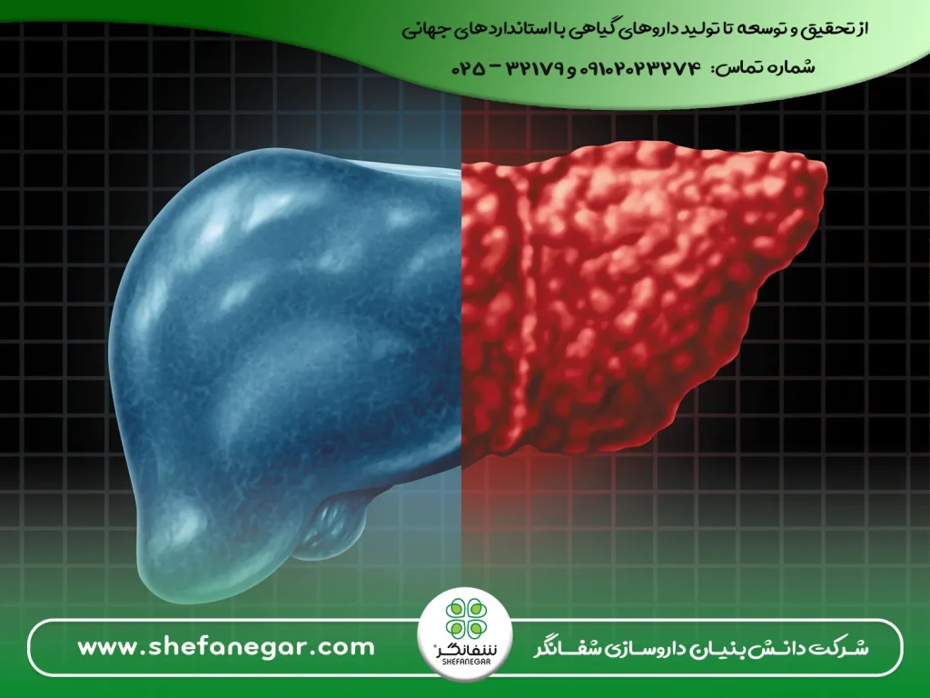 درمان-همیشگی-کبد-چرب-با-گیاهان-دارویی--راهکار-طبیعی-پاکسازی-و-تقویت-کبد-کپسول-گل-تامکیور-شفانگر